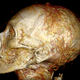 A CT scan of the head of Amenhotep I, which still has some of the pharaoh’s hair.